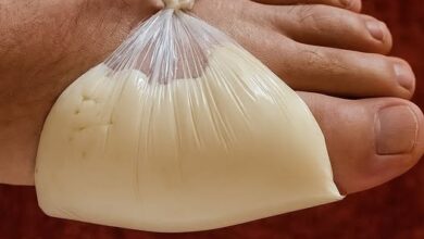 Viejo truco que actúa más rápido contra la inflamación, el dolor y la hinchazón de las articulaciones 4