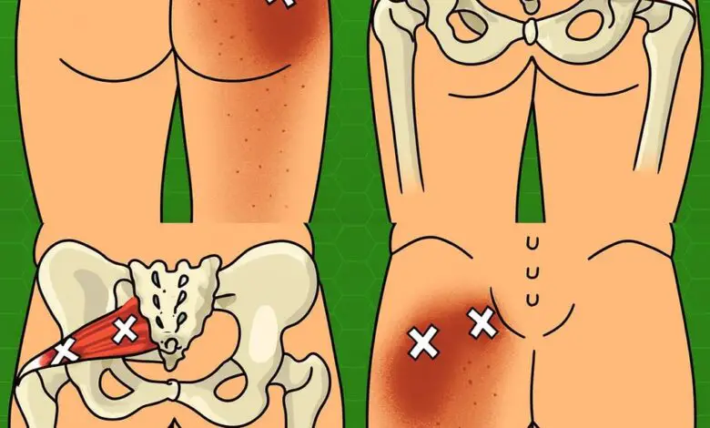 Usa estas técnicas para aliviar el dolor ciático, en la cadera y la zona lumbar 1