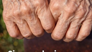 Si ves a alguien con venas hinchadas, debes decirle estas cosas 5