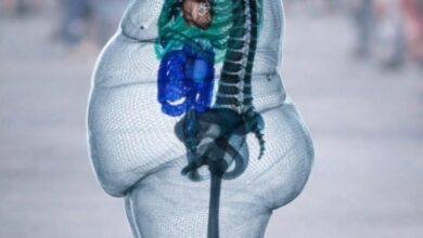 El esqueleto no cambia… pero la carga sí: la verdad silenciosa sobre la obesidad y tus huesos 4