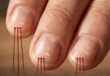 Si tienes estas líneas verticales en las uñas después de los 40, es una clara señal de…