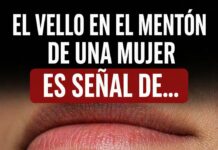 El vello en el mentón de una mujer es señal de…