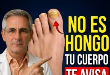 Si tus uñas de los pies están amarillas y gruesas, tu cuerpo te avisa esto (no es solo un hongo)