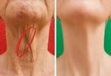 La forma más rápida de reafirmar las mejillas caídas y el “cuello de pavo