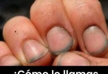 ¿Cómo llamas a una persona que tiene las uñas así?