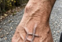 ¿Las venas visibles en las manos indican problemas en los riñones? Lo que dice la ciencia