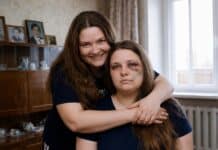 Mi hermana gemela llegó golpeada a mi casa: así le dimos una lección inolvidable a su esposo