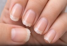 Uñas débiles y quebradizas: qué señales de salud está enviando tu cuerpo