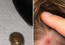 Cómo mantener la calma al encontrar insectos en el cabello de tu hijo
