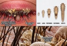 Ácaros de las pestañas: qué son los Demodex y por qué viven en tu piel