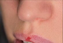 Tus labios pueden avisarte de algo: señales que conviene no ignorar