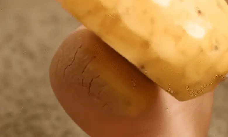El sorprendente truco de la papa para curar talones agrietados y mimar tus pies. 1