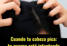 Cuando la cabeza pica, el cuerpo estáenviando un mensaje.