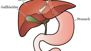 Después de la extirpación de la vesícula biliar: 3 condiciones que podrías desarrollar (¡Consulta a tu médico!)👇 5