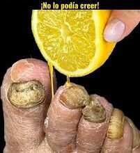 ¡La plaga en las plantas desaparece inmediatamente! ¡Simplemente rocíalo con esto! 10